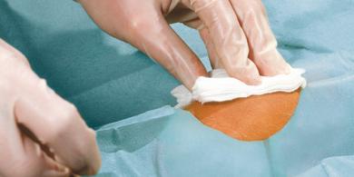 Foliodrape Protect Lochtuch - 50 x 60 cm, 7 cm Loch