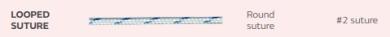 Looped Suture - USP#2 - gerade - cobraid